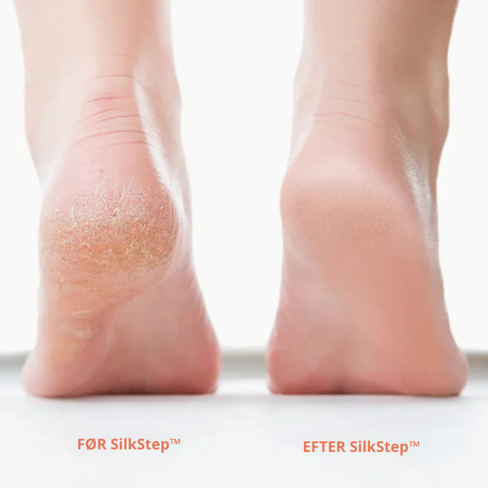 SilkStep™ – Lena Fødder På Få Minutter