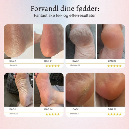 SilkStep™ – Lena Fødder På Få Minutter